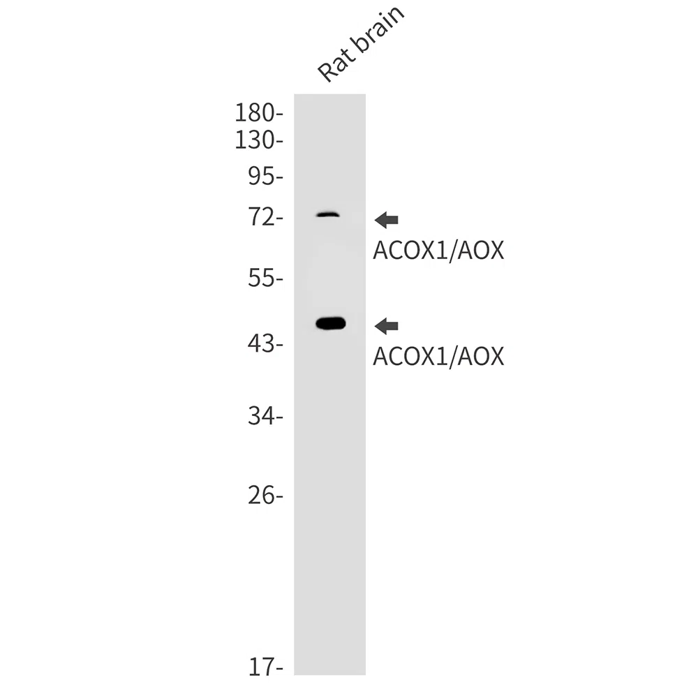 ACOX1 Rabbit Monoclonal Antibody - Size: 50µl