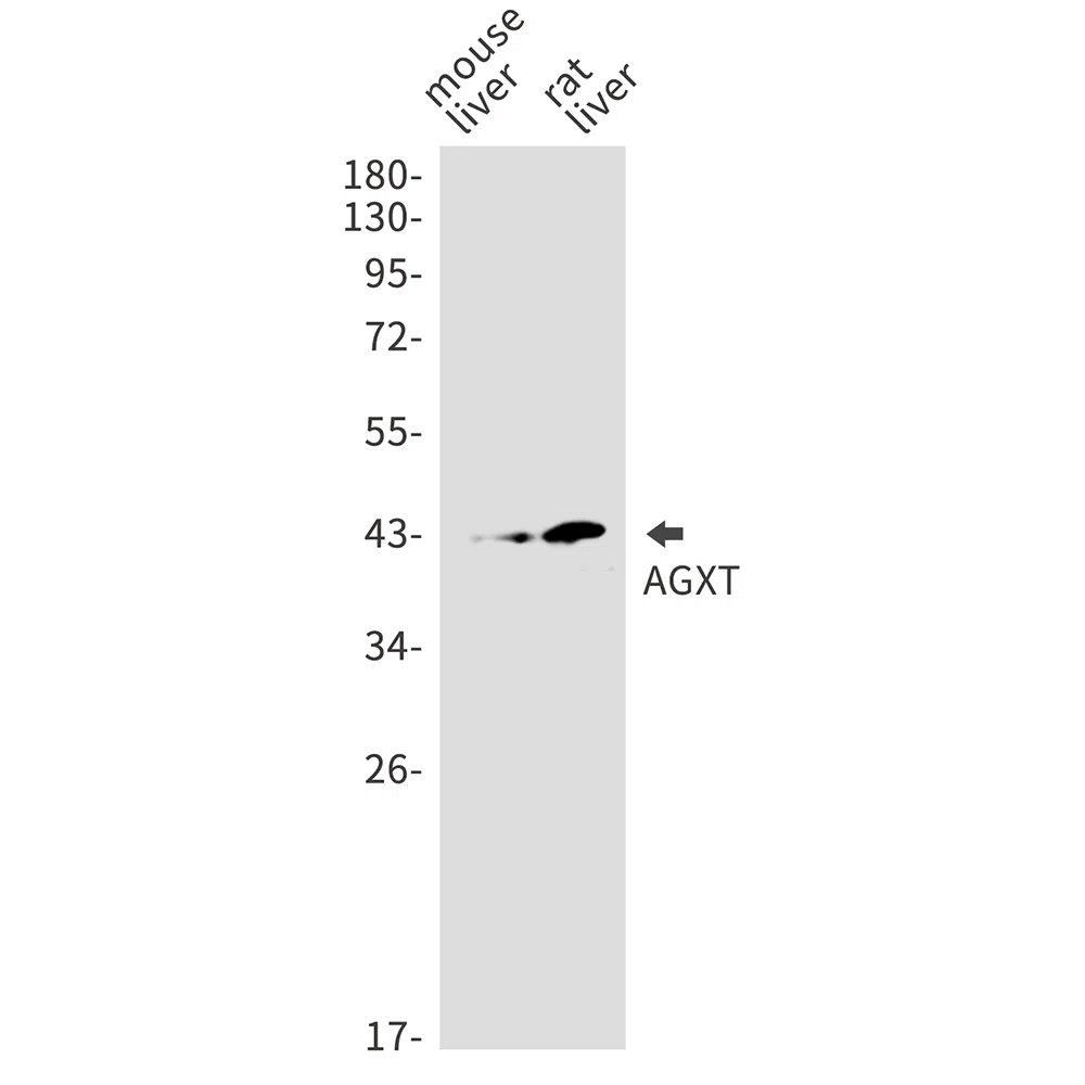 AGXT Rabbit Monoclonal Antibody - Size: 100µl