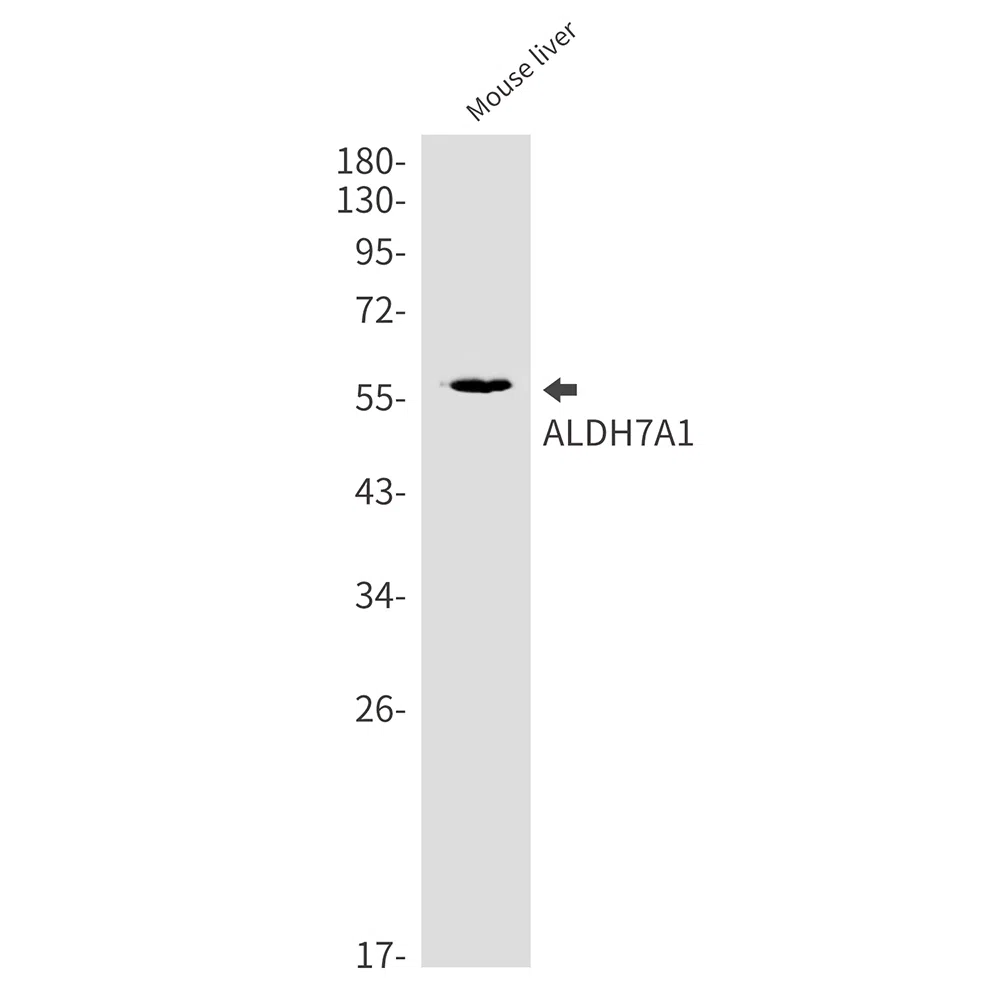 ALDH7A1 Rabbit Monoclonal Antibody - Size: 50µl