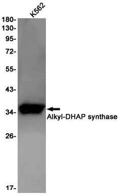 AGPS Rabbit Monoclonal Antibody - Size: 50µl