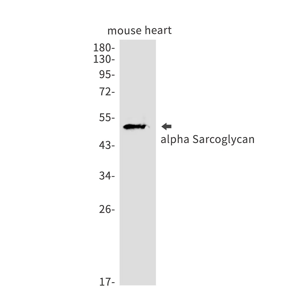 alpha Sarcoglycan Rabbit Monoclonal Antibody - Size: 50µl