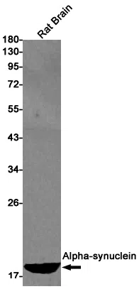 alpha Synuclein Rabbit Monoclonal Antibody