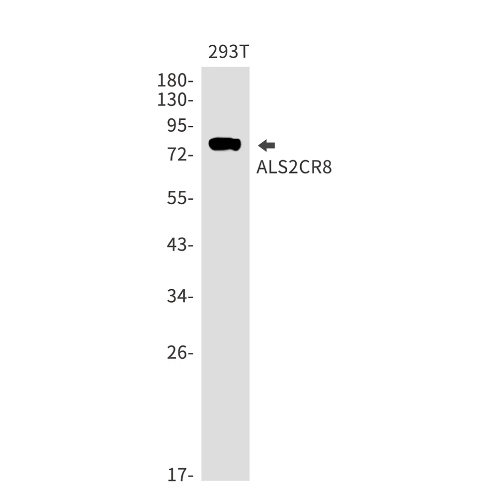 ALS2CR8 Rabbit Monoclonal Antibody