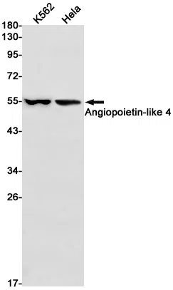 Angiopoietin Like 4 Rabbit Monoclonal Antibody - Size: 100µl