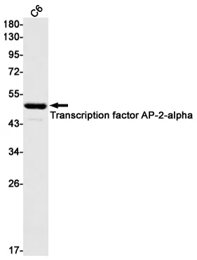 AP2 alpha Rabbit Monoclonal Antibody