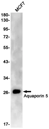 Aquaporin 5 Rabbit Monoclonal Antibody - Size: 100µl
