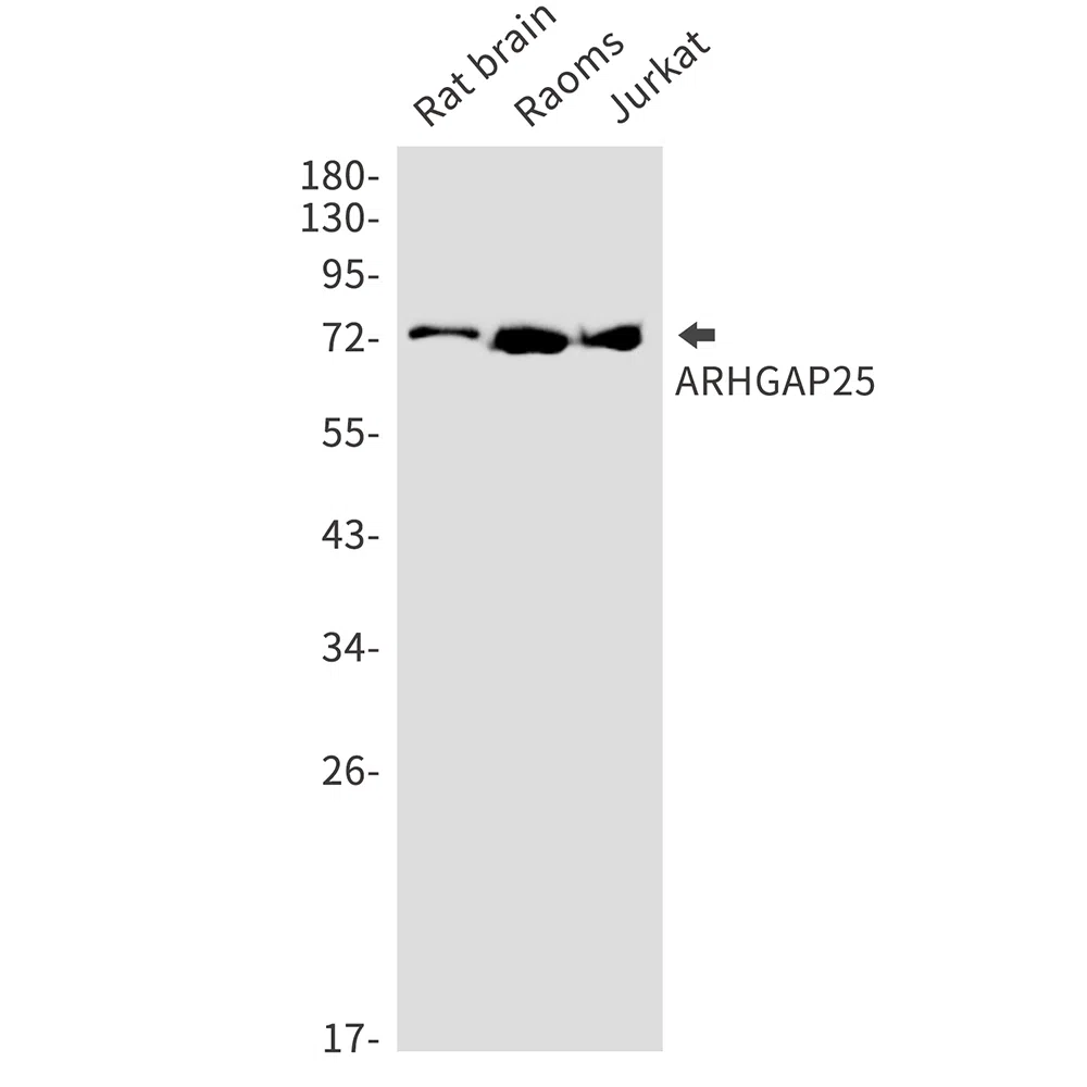 ARHGAP25 Rabbit Monoclonal Antibody - Size: 50µl