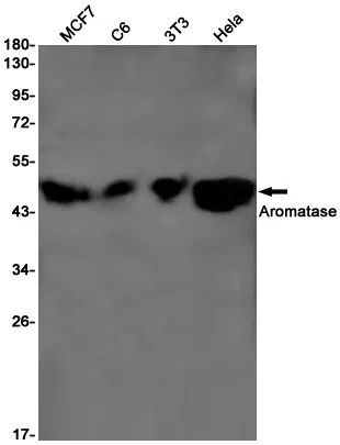 Aromatase Rabbit Monoclonal Antibody - Size: 100µl