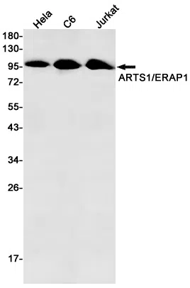 ERAP1 Rabbit Monoclonal Antibody - Size: 100µl