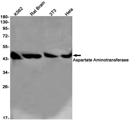 Aspartate Aminotransferase Rabbit Monoclonal Antibody - Size: 100µl