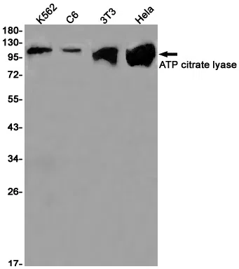 ATP Citrate lyase Rabbit Monoclonal Antibody - Size: 50µl