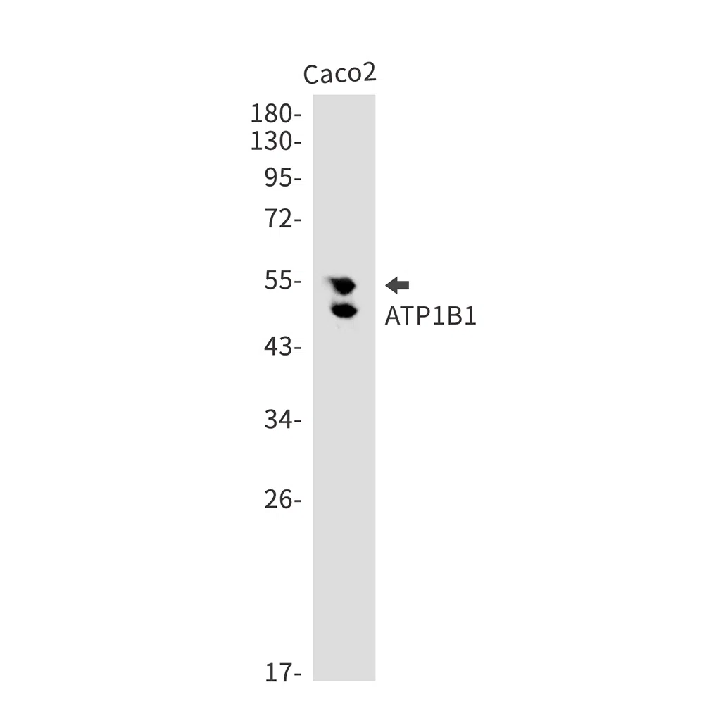 ATP1B1 Rabbit Monoclonal Antibody - Size: 100µl