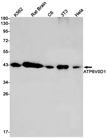 ATP6V0D1 Rabbit Monoclonal Antibody - Size: 50µl