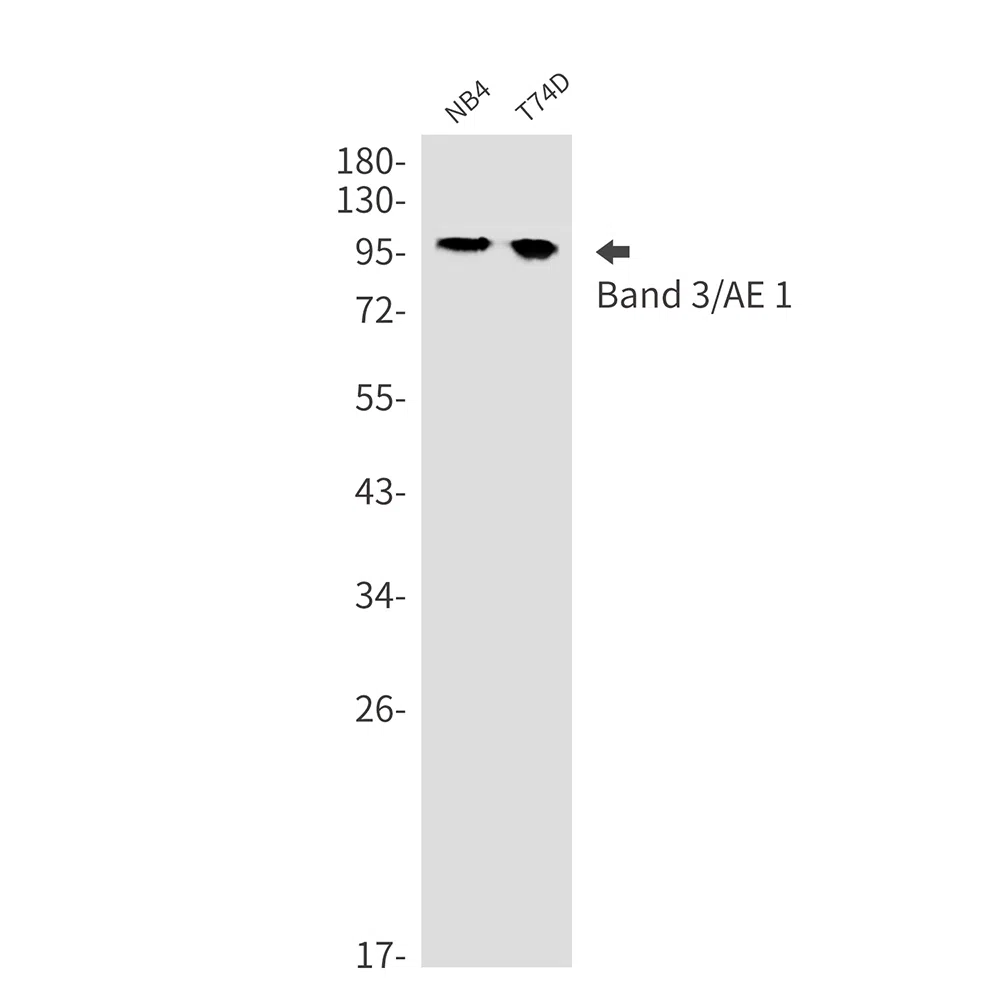 Band 3 Rabbit Monoclonal Antibody - Size: 100µl