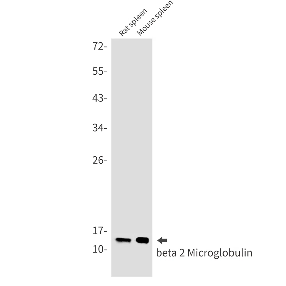beta 2 Microglobulin Rabbit Monoclonal Antibody - Size: 100µl