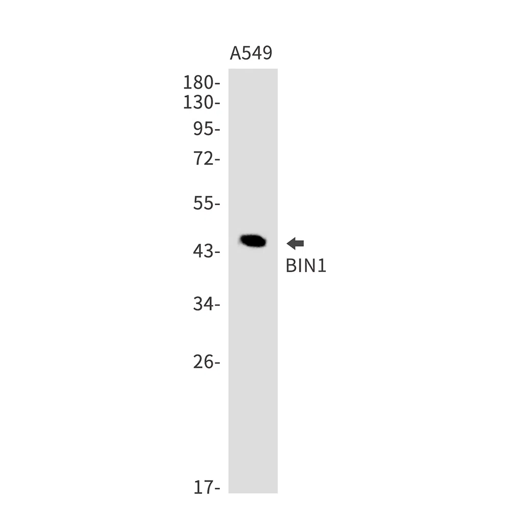 BIN1 Rabbit Monoclonal Antibody - Size: 50µl
