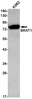 BRAT1 Rabbit Monoclonal Antibody - Size: 50µl
