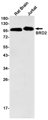 BRD2 Rabbit Monoclonal Antibody - Size: 50µl