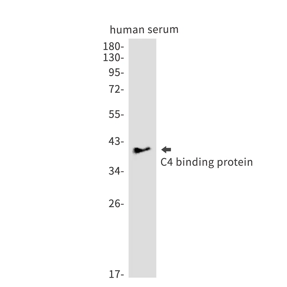 C4 Binding Protein Rabbit Monoclonal Antibody - Size: 50µl