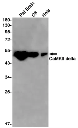 CaMKII delta Rabbit Monoclonal Antibody - Size: 100µl