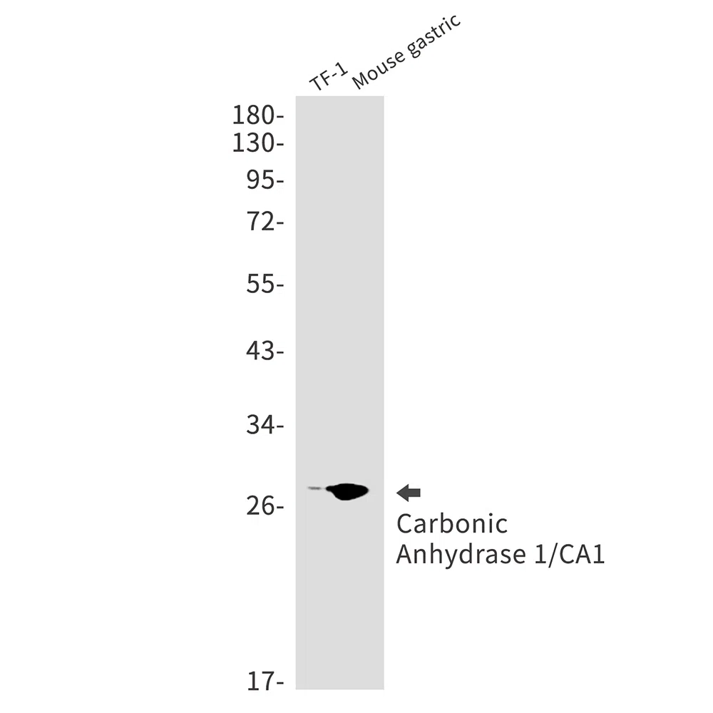 Carbonic Anhydrase 1 Rabbit Monoclonal Antibody - Size: 50µl