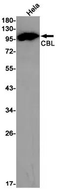 CBL Rabbit Monoclonal Antibody - Size: 100µl