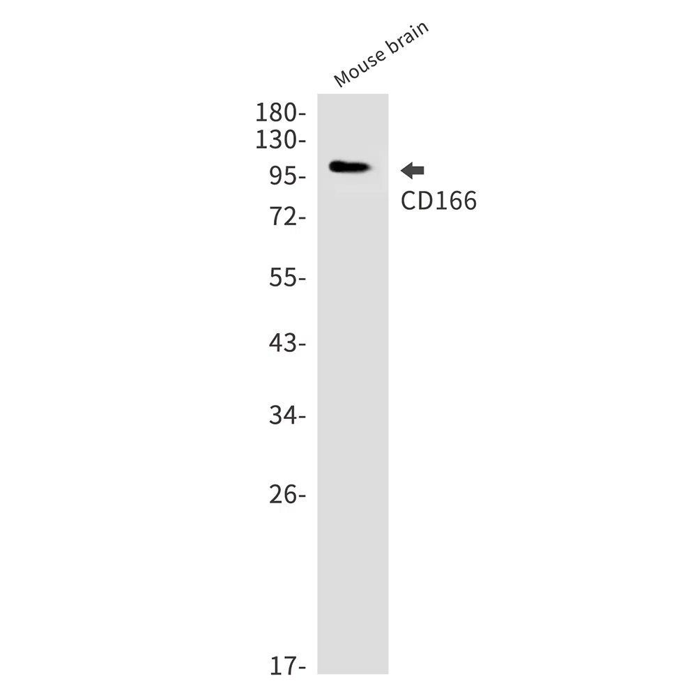 CD166 Rabbit Monoclonal Antibody - Size: 50µl