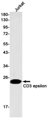 CD3 epsilon Rabbit Monoclonal Antibody - Size: 100µl
