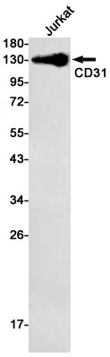 CD31 Rabbit Monoclonal Antibody - Size: 100µl
