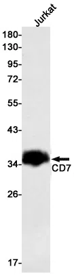CD7 Rabbit Monoclonal Antibody - Size: 100µl
