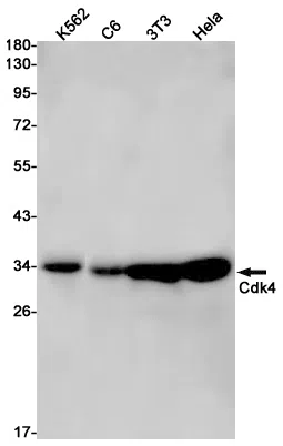 CDK4 Rabbit Monoclonal Antibody - Size: 100µl