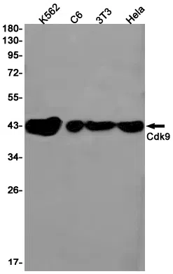 CDK9 Rabbit Monoclonal Antibody - Size: 50µl