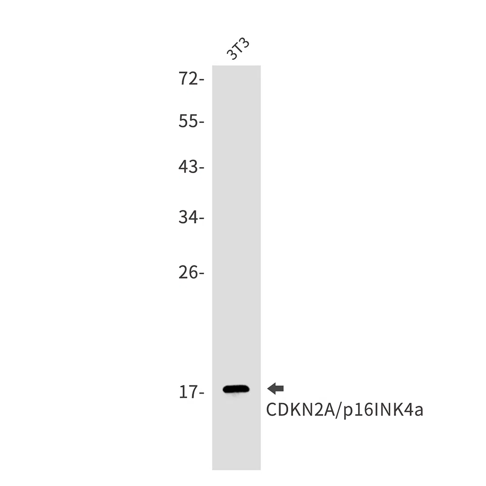 CDKN2A/p16INK4a Rabbit Monoclonal Antibody - Size: 50µl
