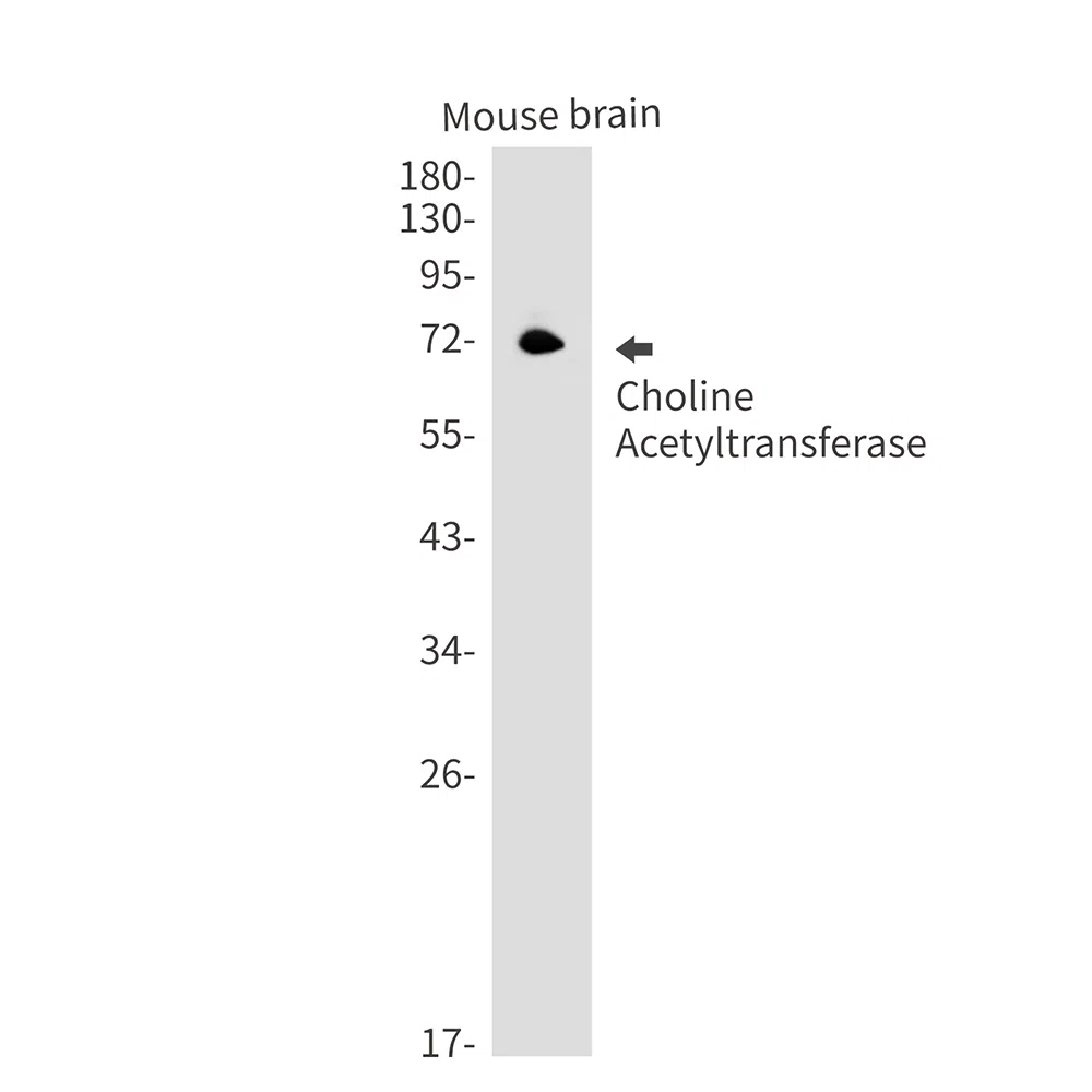 Choline Acetyltransferase Rabbit Monoclonal Antibody - Size: 50µl