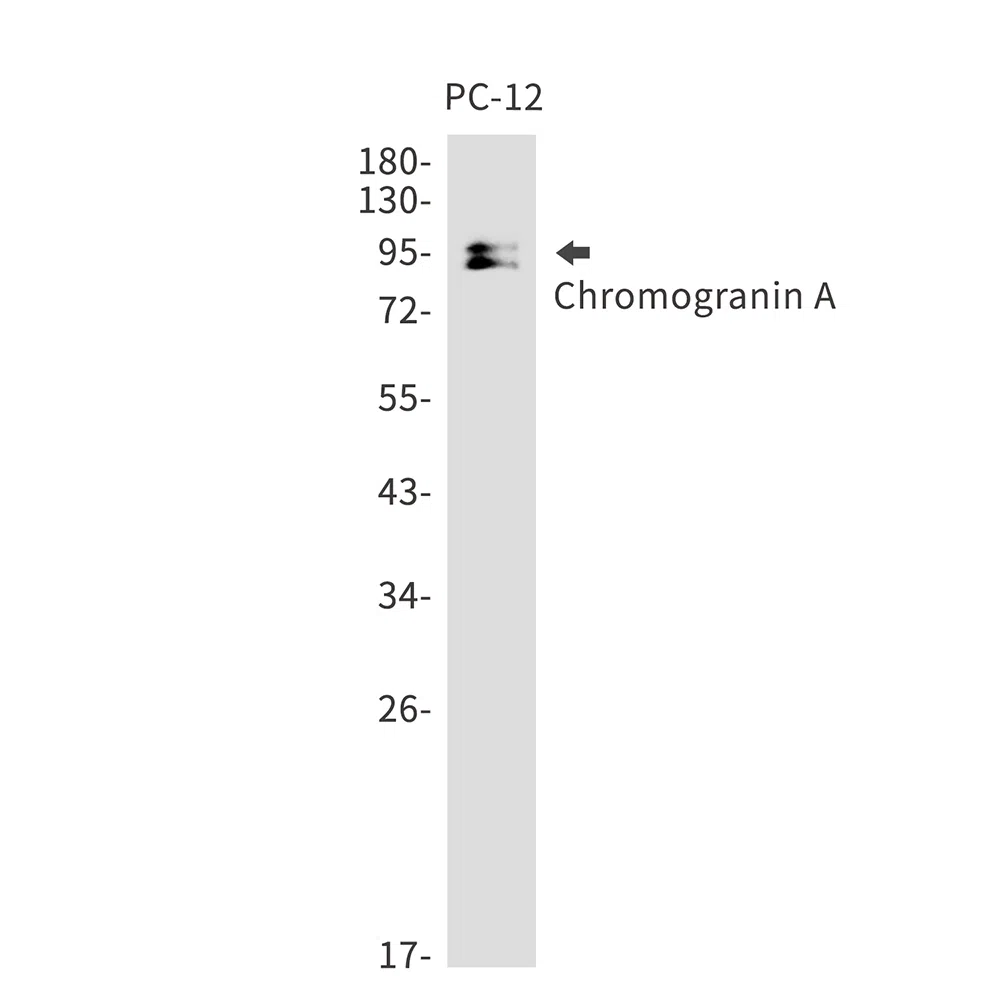 Chromogranin A Rabbit Monoclonal Antibody - Size: 50µl