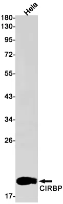 CIRBP Rabbit Monoclonal Antibody - Size: 50µl
