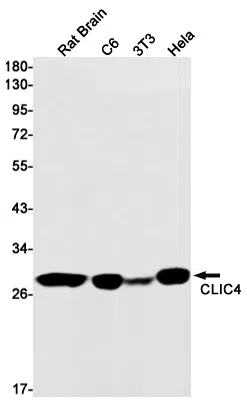 CLIC4 Rabbit Monoclonal Antibody - Size: 100µl
