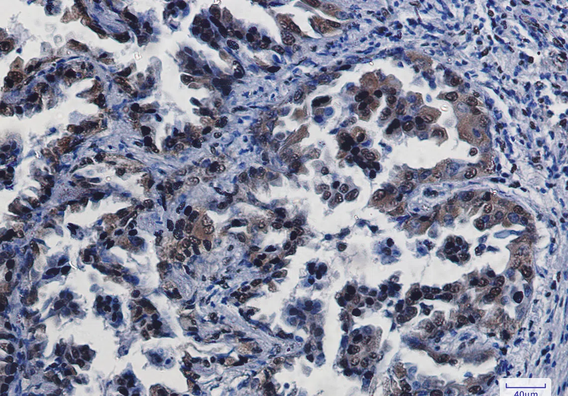 Immunohistochemistry(IHC) - CREB Rabbit Monoclonal Antibody AMRe85455