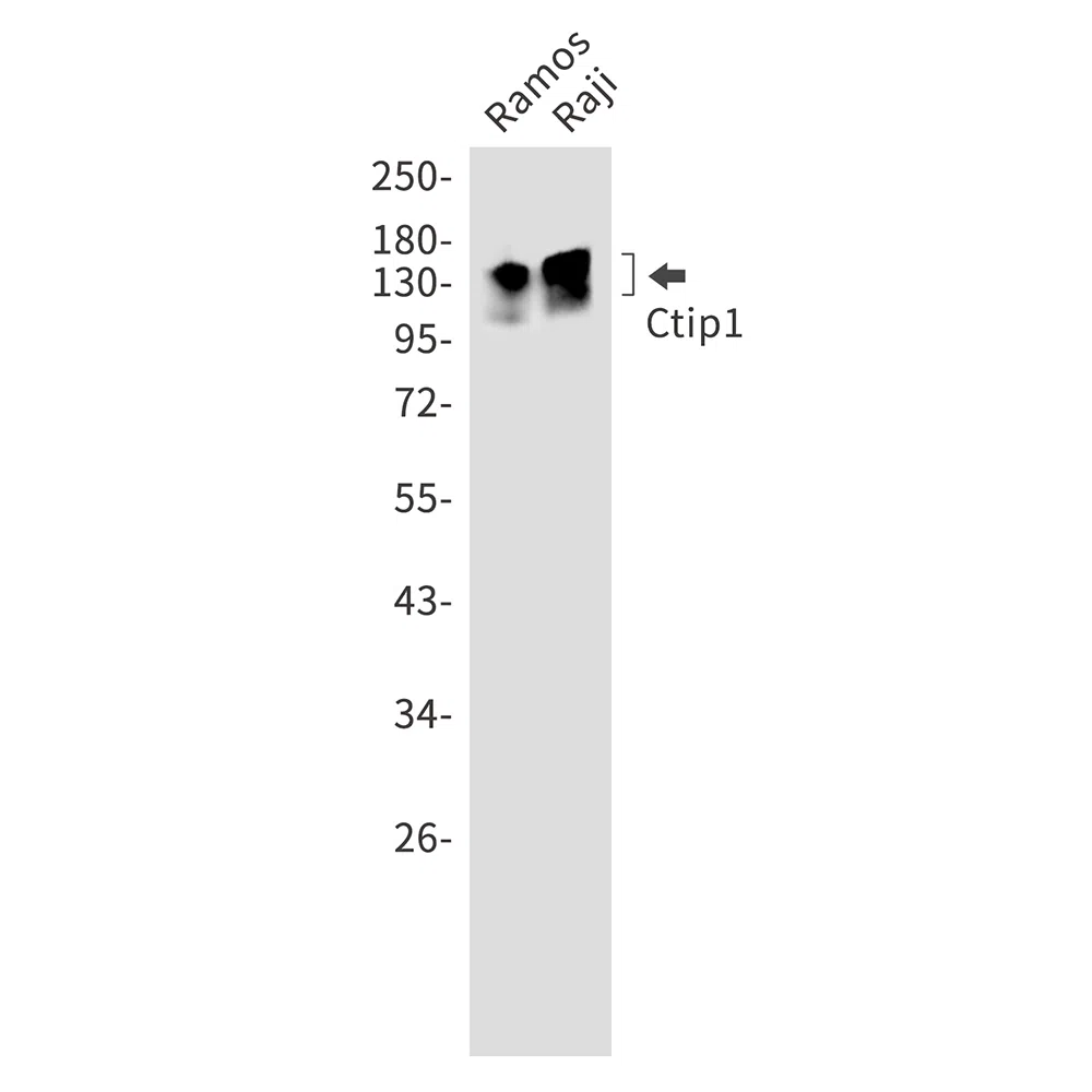 Ctip1 Rabbit Monoclonal Antibody - Size: 50µl