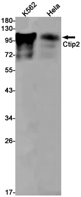 Ctip2 Rabbit Monoclonal Antibody - Size: 50µl