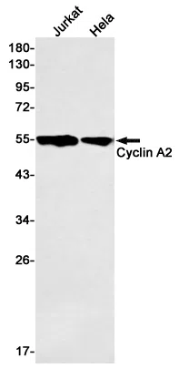 Cyclin A2 Rabbit Monoclonal Antibody - Size: 50µl