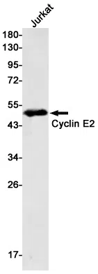 Cyclin E2 Rabbit Monoclonal Antibody - Size: 50µl