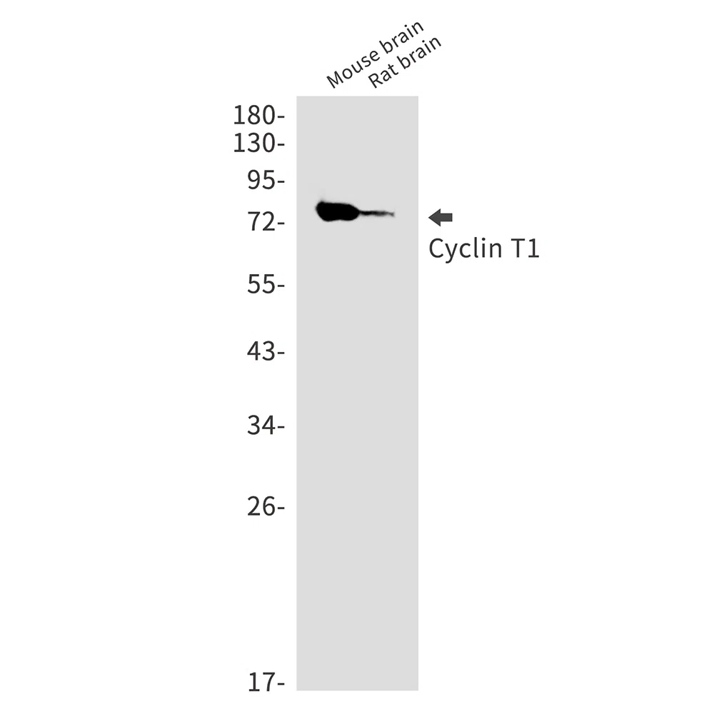Cyclin T1 Rabbit Monoclonal Antibody - Size: 100µl