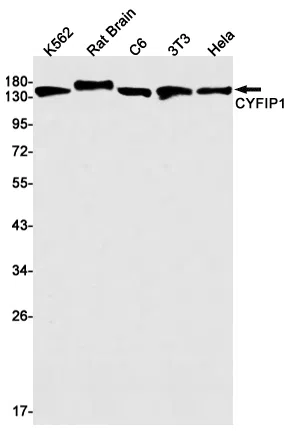 CYFIP1 Rabbit Monoclonal Antibody - Size: 50µl