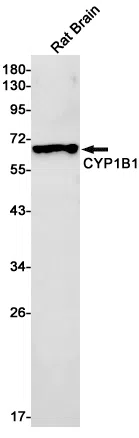 Cytochrome P450 1B1 Rabbit Monoclonal Antibody - Size: 50µl