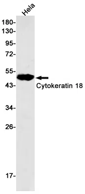 Cytokeratin 18 Rabbit Monoclonal Antibody - Size: 50µl