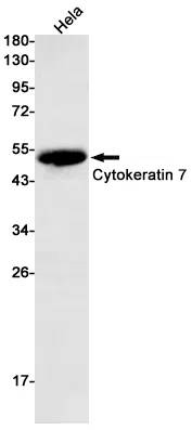 Cytokeratin 7 Rabbit Monoclonal Antibody - Size: 100µl