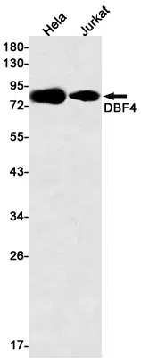 DBF4 Rabbit Monoclonal Antibody - Size: 50µl