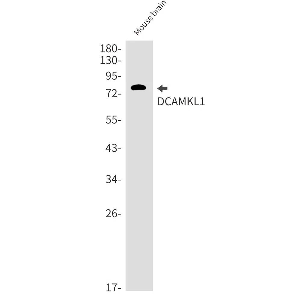 DCAMKL1 Rabbit Monoclonal Antibody - Size: 50µl
