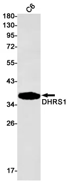 DHRS1 Rabbit Monoclonal Antibody - Size: 100µl
